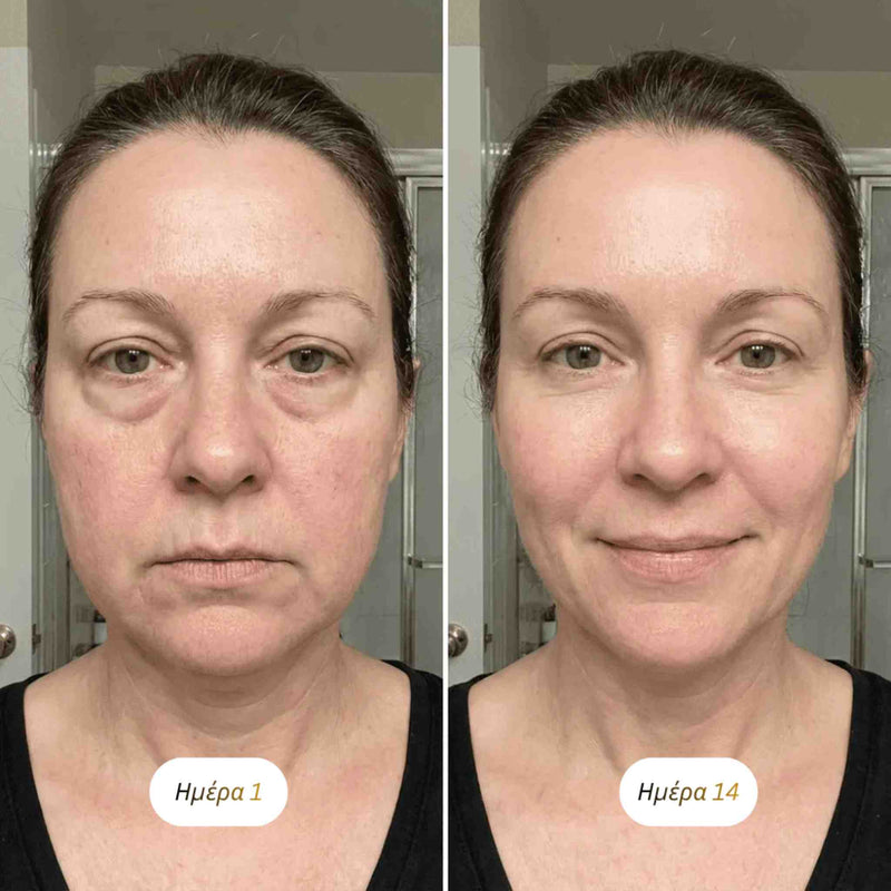 Slovakia lymphatic brush